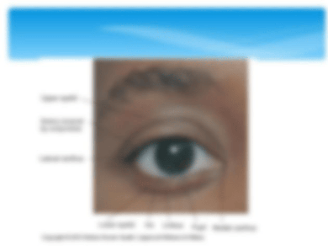 NU650 EYE.ppt_dwcibz8h9fr_page4