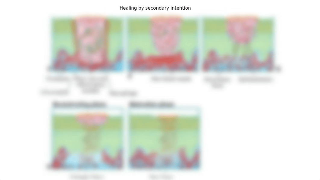 Module_2_Mech_defense_CSs(1) (1).pptx_dwclag46ize_page5