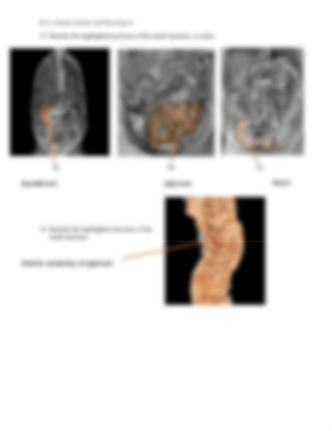 Unit 5 Assignment Real Anatomy WS.pdf_dwhgjqclcml_page5