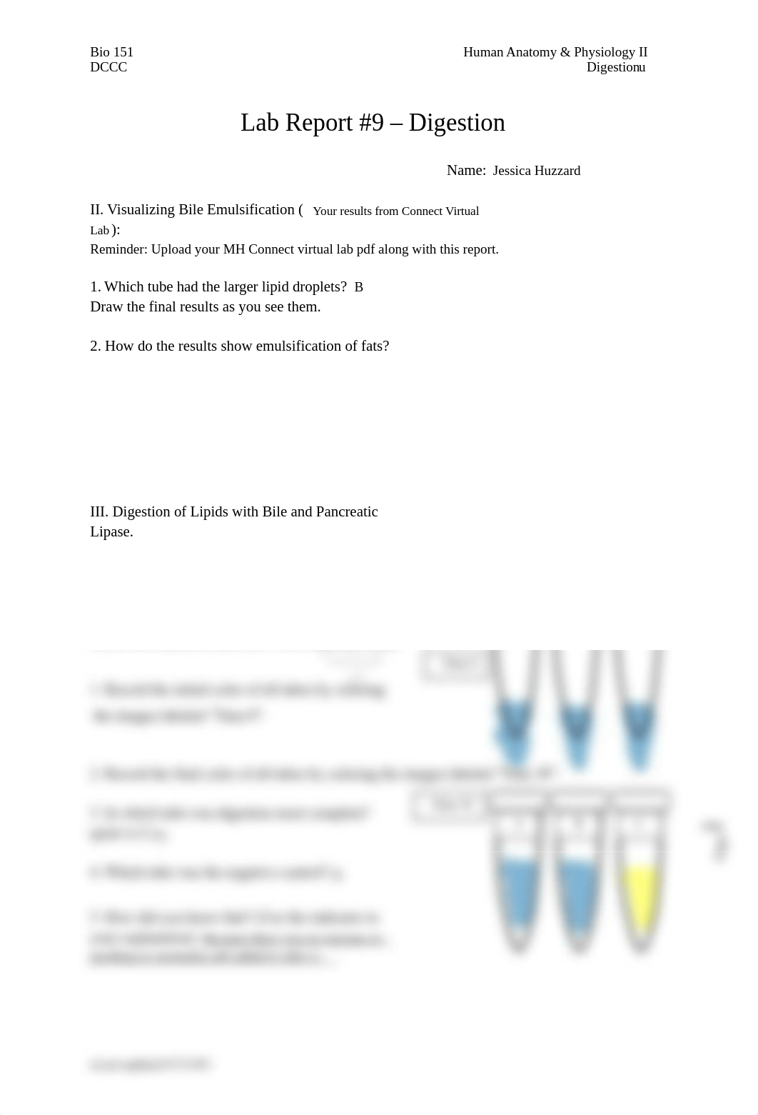 BIO 151 Lab #9 Digestion ff.docx_dwjgo7j63p8_page1