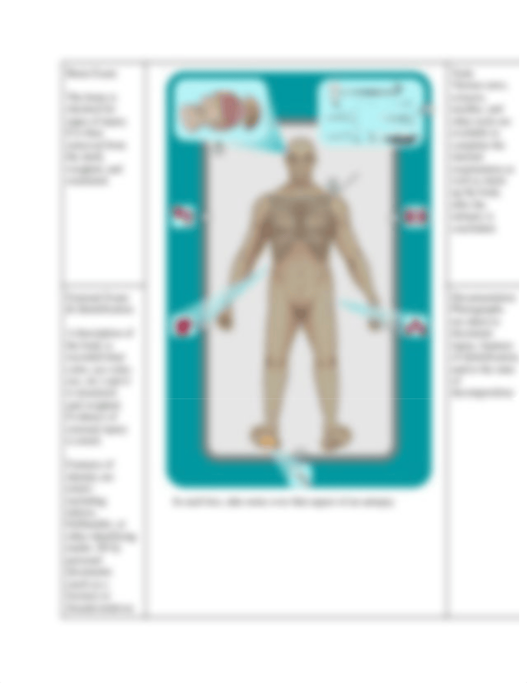 1.2.1 Anatomy of an Autopsy Day 27 -Tony Xue (1).pdf_dwnedplm4wn_page3