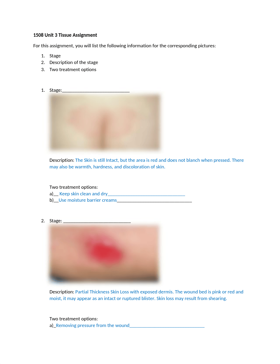 Unit 3 Tissue Assignment MJ.docx_dwywsmam50u_page1