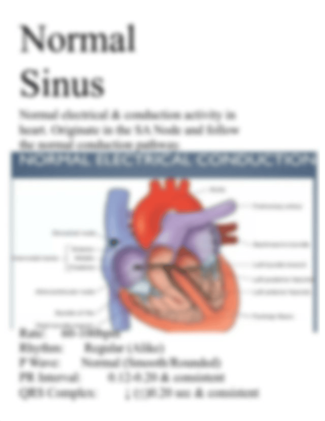 Cardiac Dysrhythmias Study Guide.docx_dwz9c1v2fdo_page5