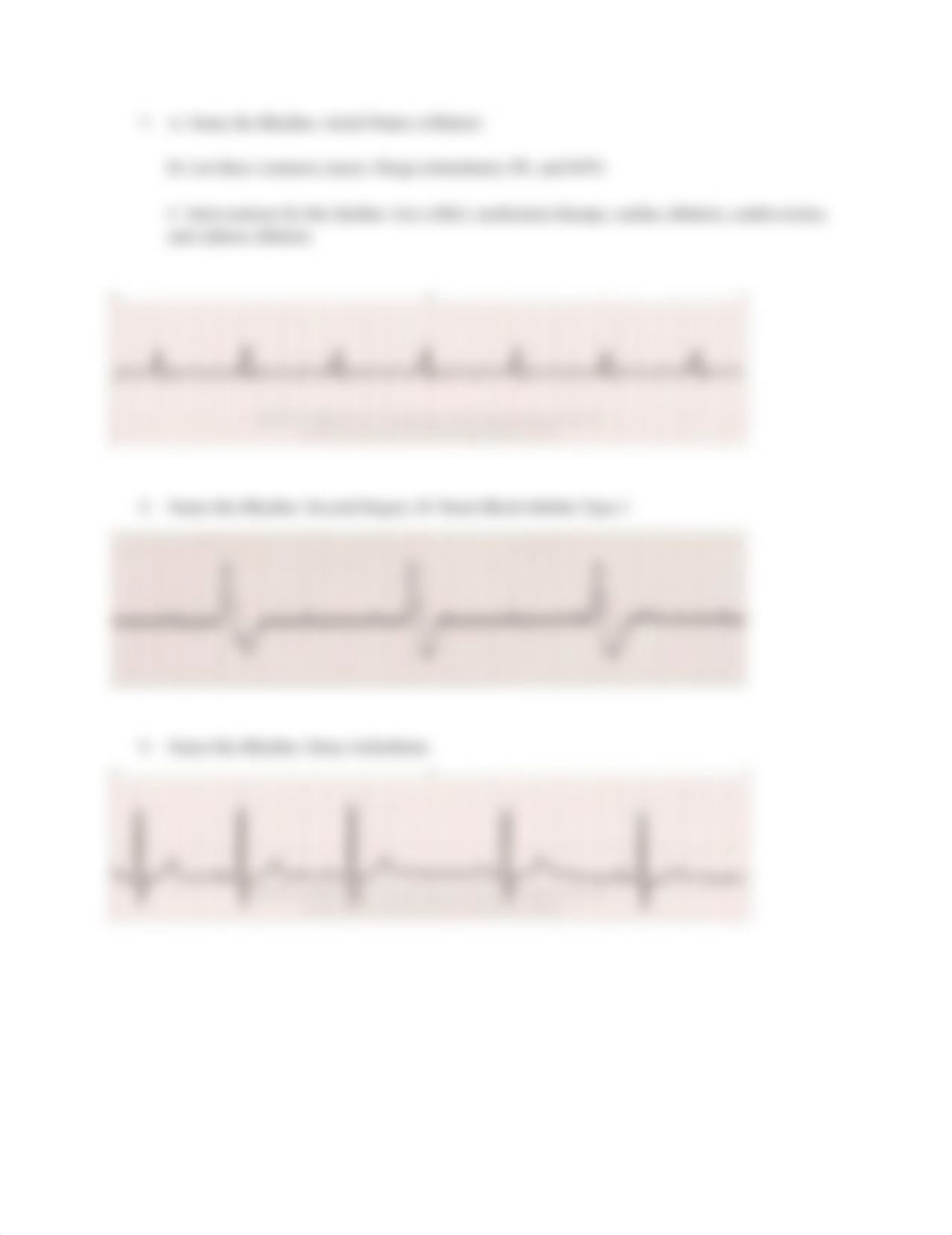 EKG Worksheet (Adult Health 2).docx_dx22om062xr_page3