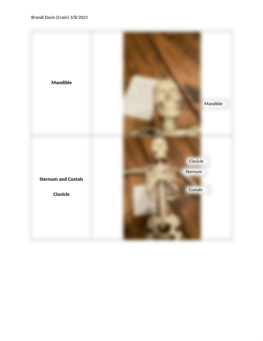 Lab Report 5 Overview of the Skeletal System.docx_dx3oqsajtxr_page3