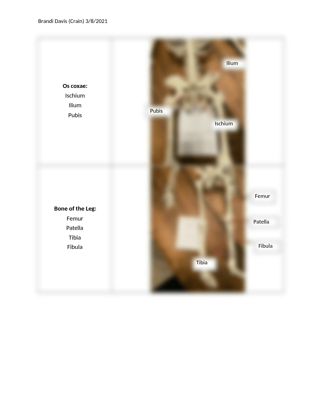 Lab Report 5 Overview of the Skeletal System.docx_dx3oqsajtxr_page5