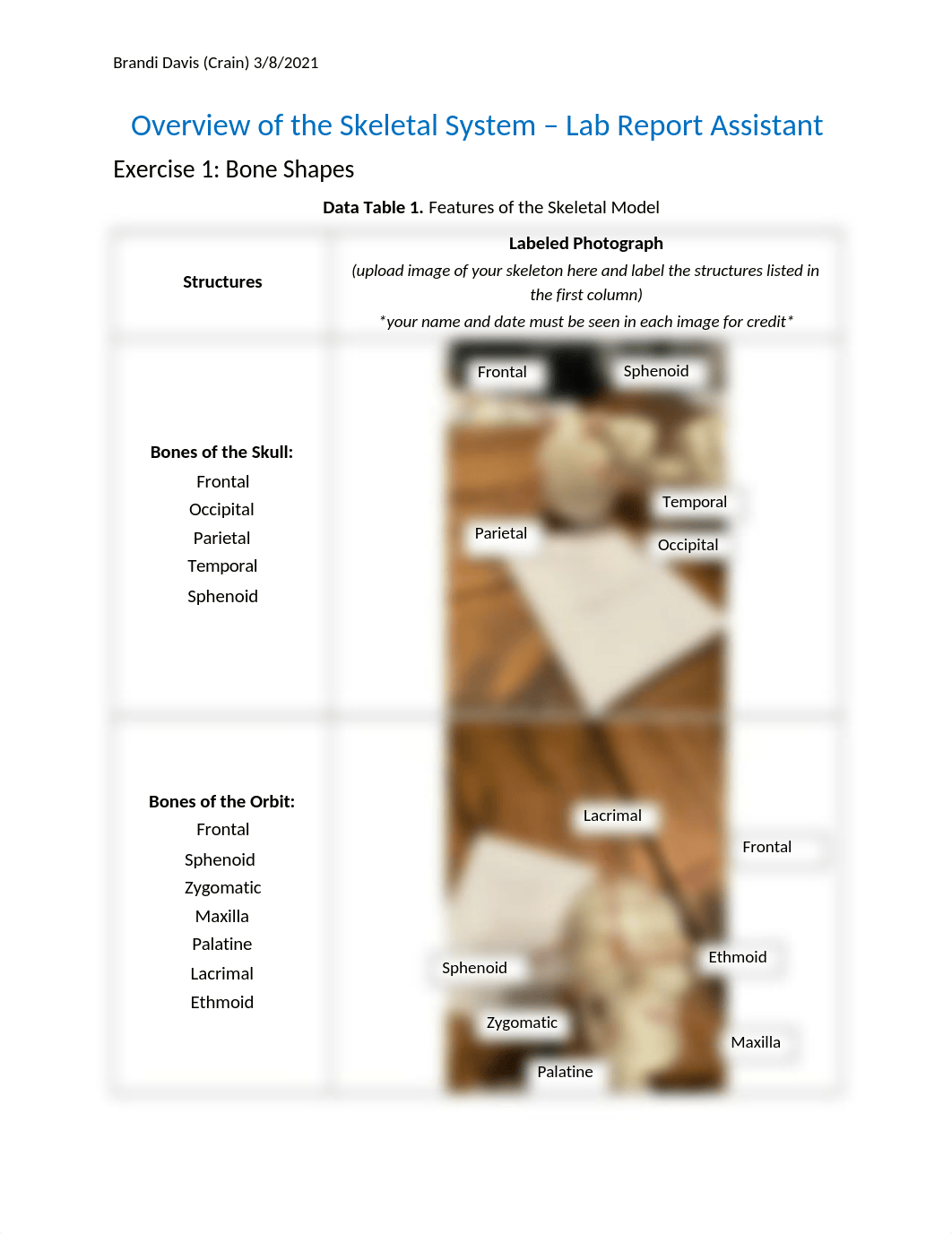 Lab Report 5 Overview of the Skeletal System.docx_dx3oqsajtxr_page1