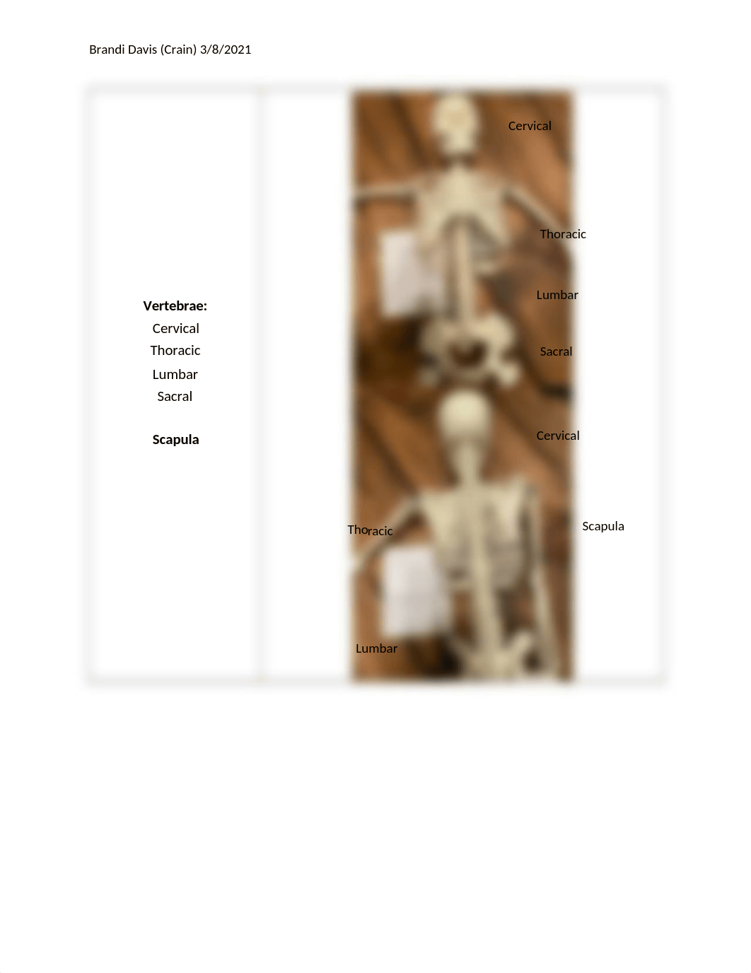 Lab Report 5 Overview of the Skeletal System.docx_dx3oqsajtxr_page2