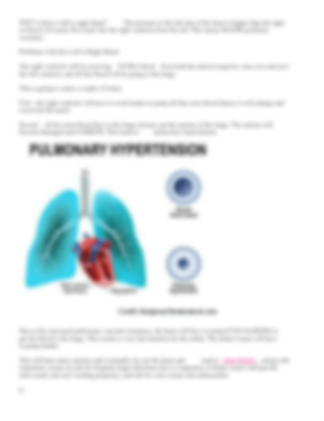 Ventricular Septal Defect.docx_dx5ok6n9dhd_page4