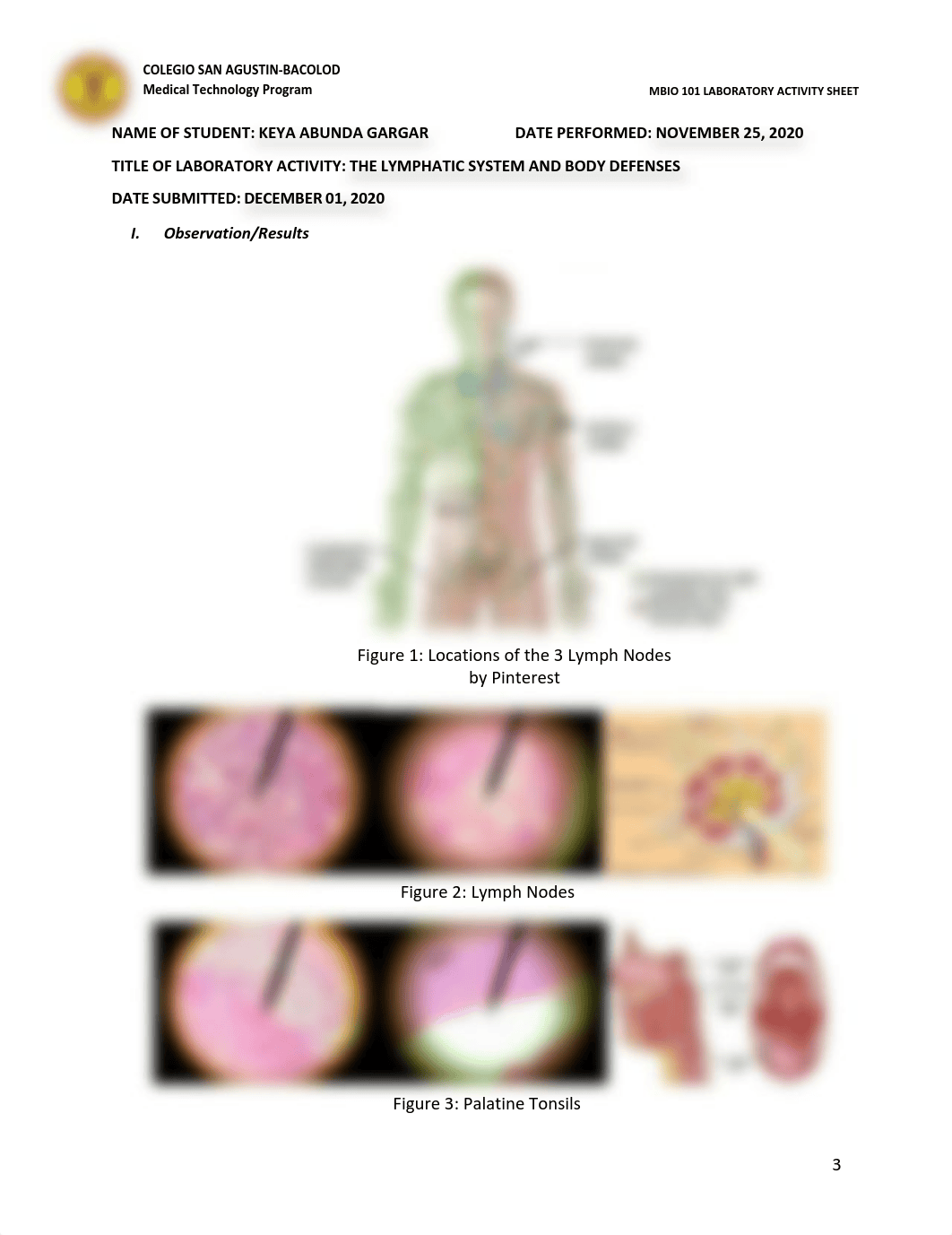 Gargar, Keya_BSMT-1A_Actvitiy#12 (Lymphatic System)_12-01-2020.pdf_dx8nxkk1tm1_page3