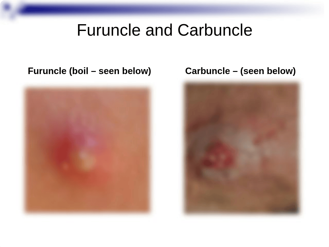 Infectious  Diseases Affecting the Skin (2).ppt_dxdmaqk2fsm_page4