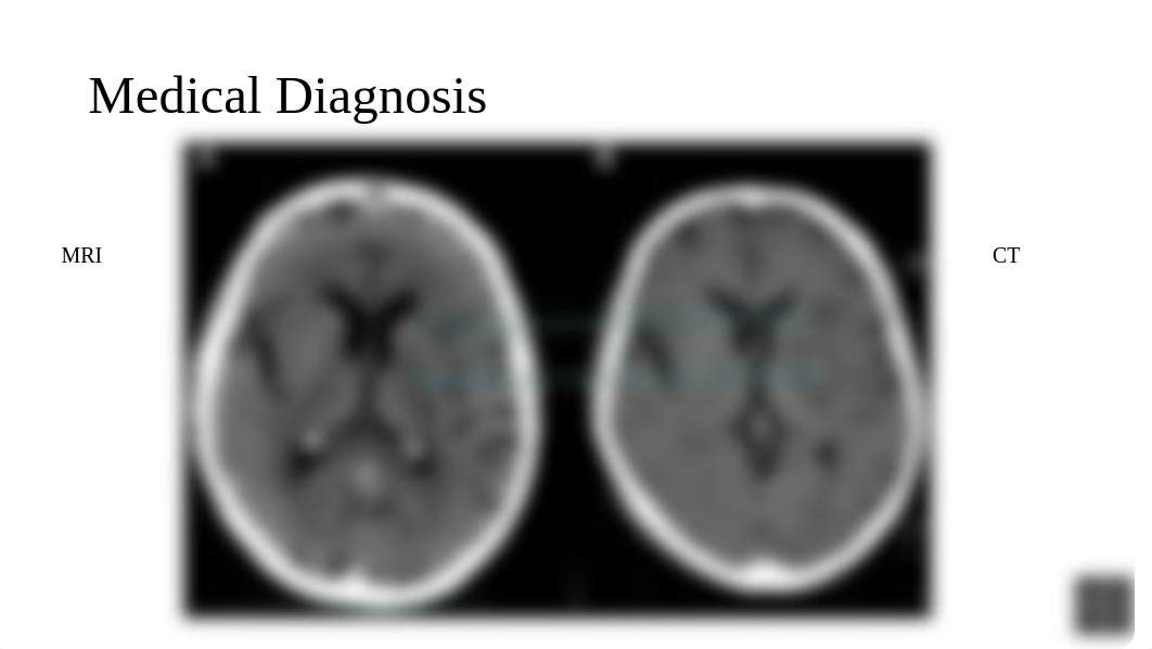 Examination of patients who have had a stroke 2.10.pptx_dxew0dnsss5_page5