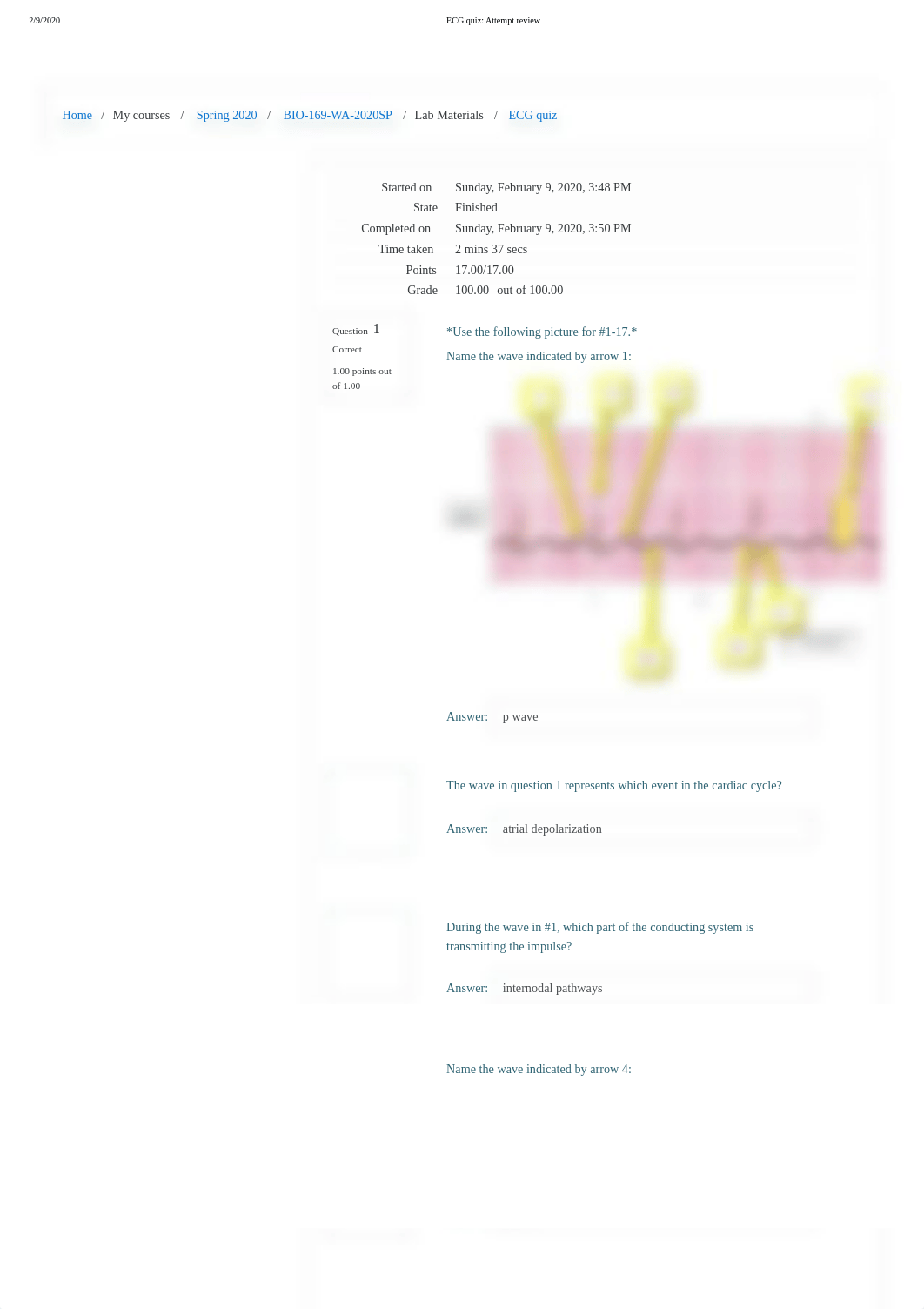 ECG Quiz.pdf_dxf37xy9h4j_page1