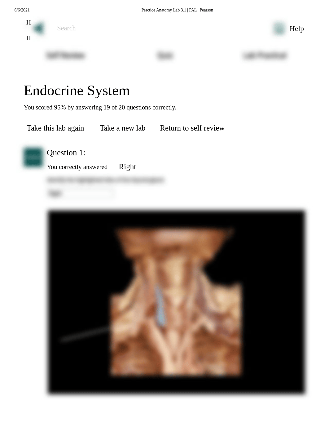 Doris Bowdre Lab 1 Exercise Endocrine system Pal Lab Practical.pdf_dxfevc6e9ag_page1