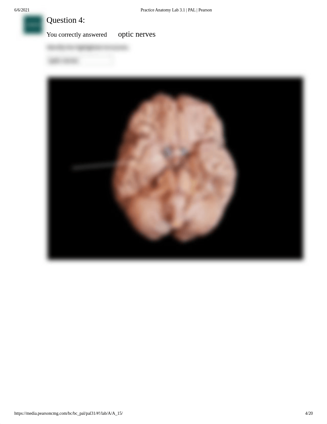 Doris Bowdre Lab 1 Exercise Endocrine system Pal Lab Practical.pdf_dxfevc6e9ag_page4