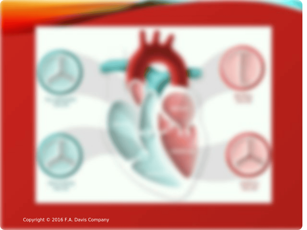 Ch18 Valvular Heart Disease(1).pptx_dxh6gkb9730_page5