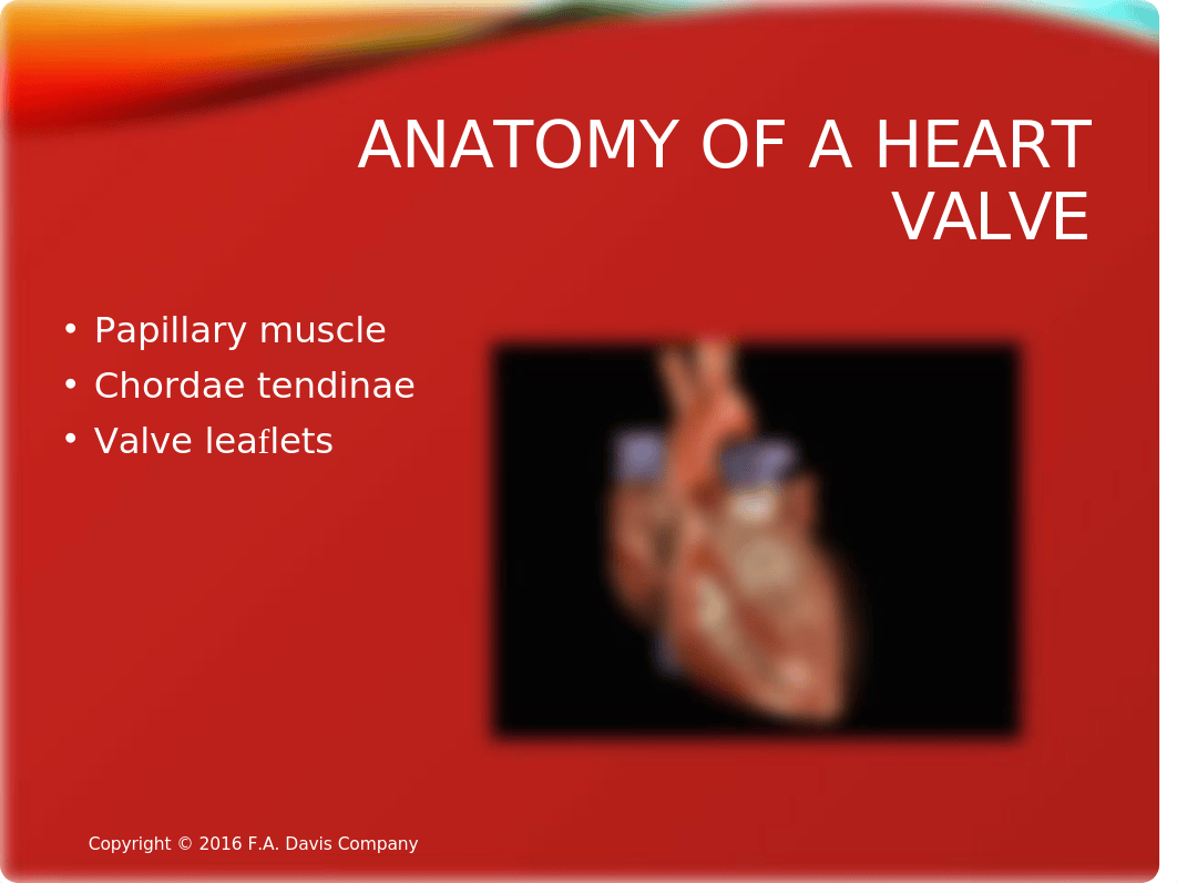 Ch18 Valvular Heart Disease(1).pptx_dxh6gkb9730_page3