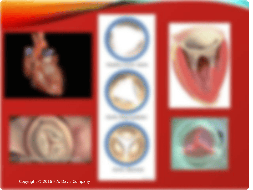 Ch18 Valvular Heart Disease(1).pptx_dxh6gkb9730_page2