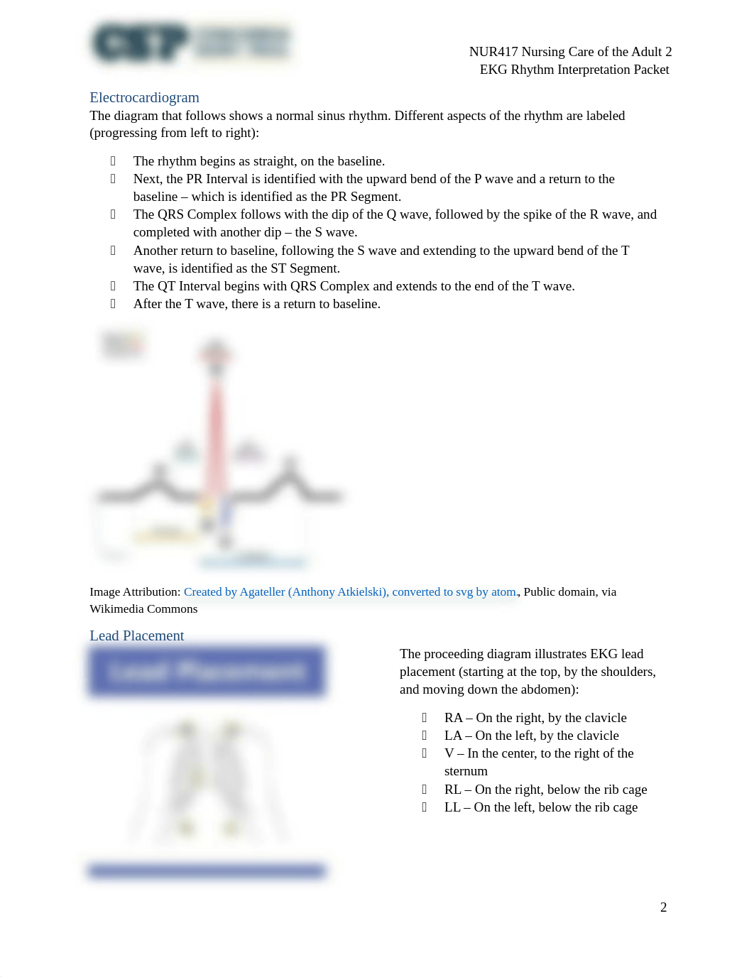 NUR417 EKG Rhythm Interpretation Packet (1).docx_dxi1xni00kv_page2