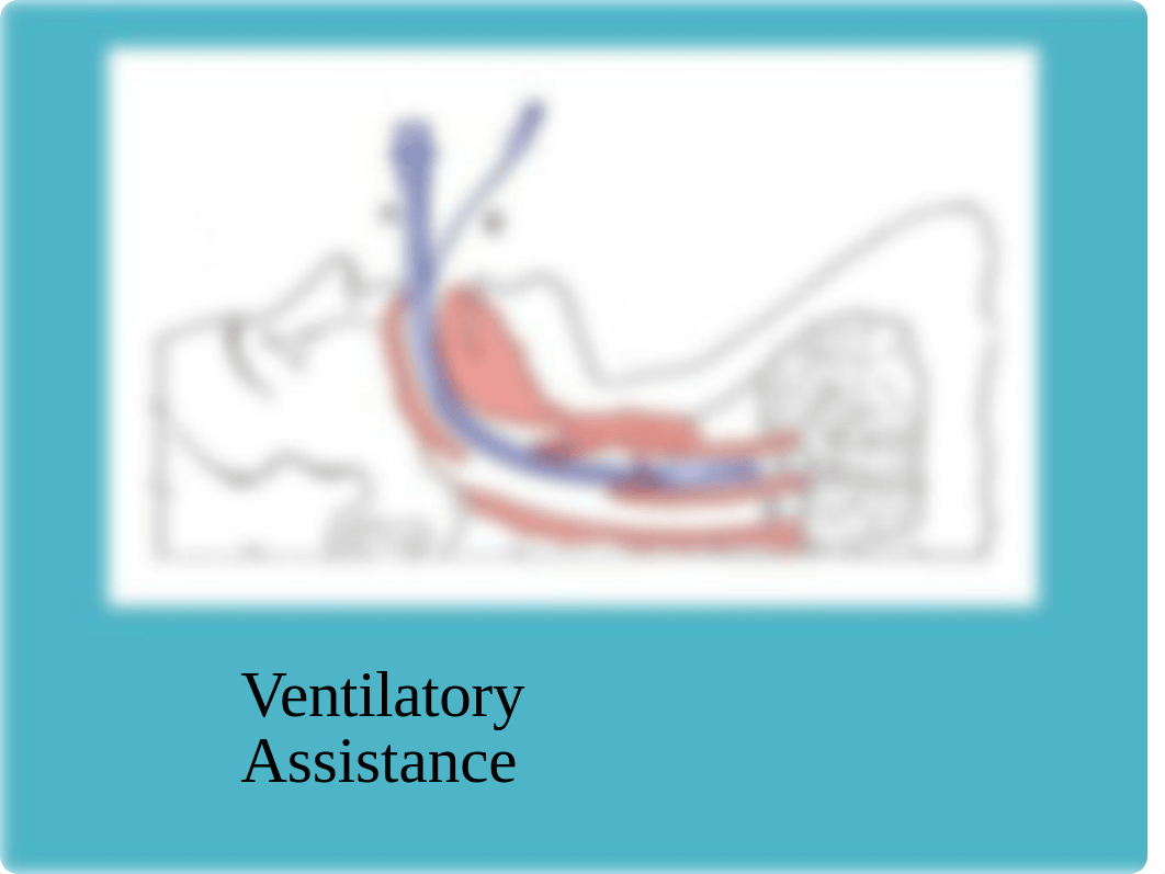 NUR 434 Ventilatory Assistance 2019.ppt_dxidptxng2e_page1