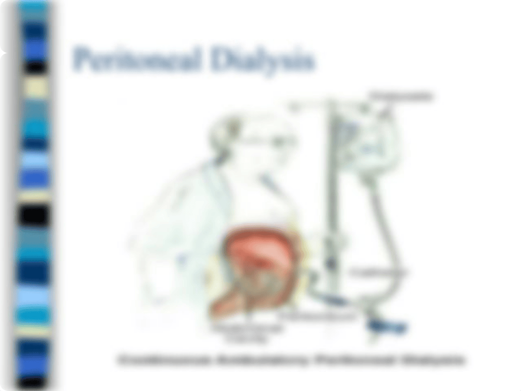 Tutoring 21 Renal Dialysis[1].ppt, 2008.ppt_dxm9zuqkh85_page5