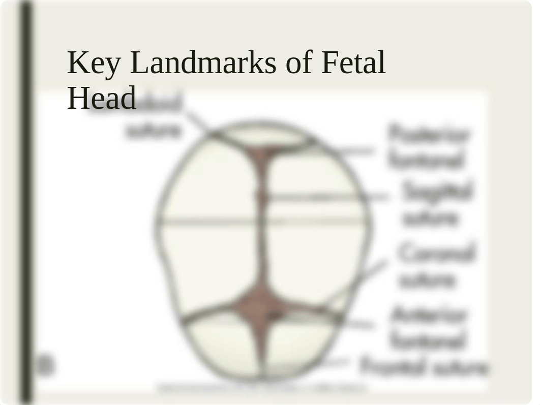 Intrapartum 2.pptx_dxmny7hbr8k_page3