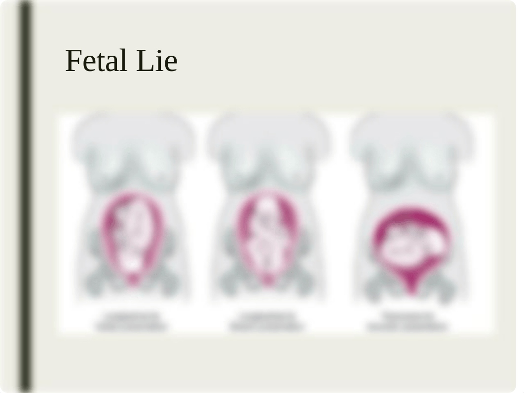 Intrapartum 2.pptx_dxmny7hbr8k_page5