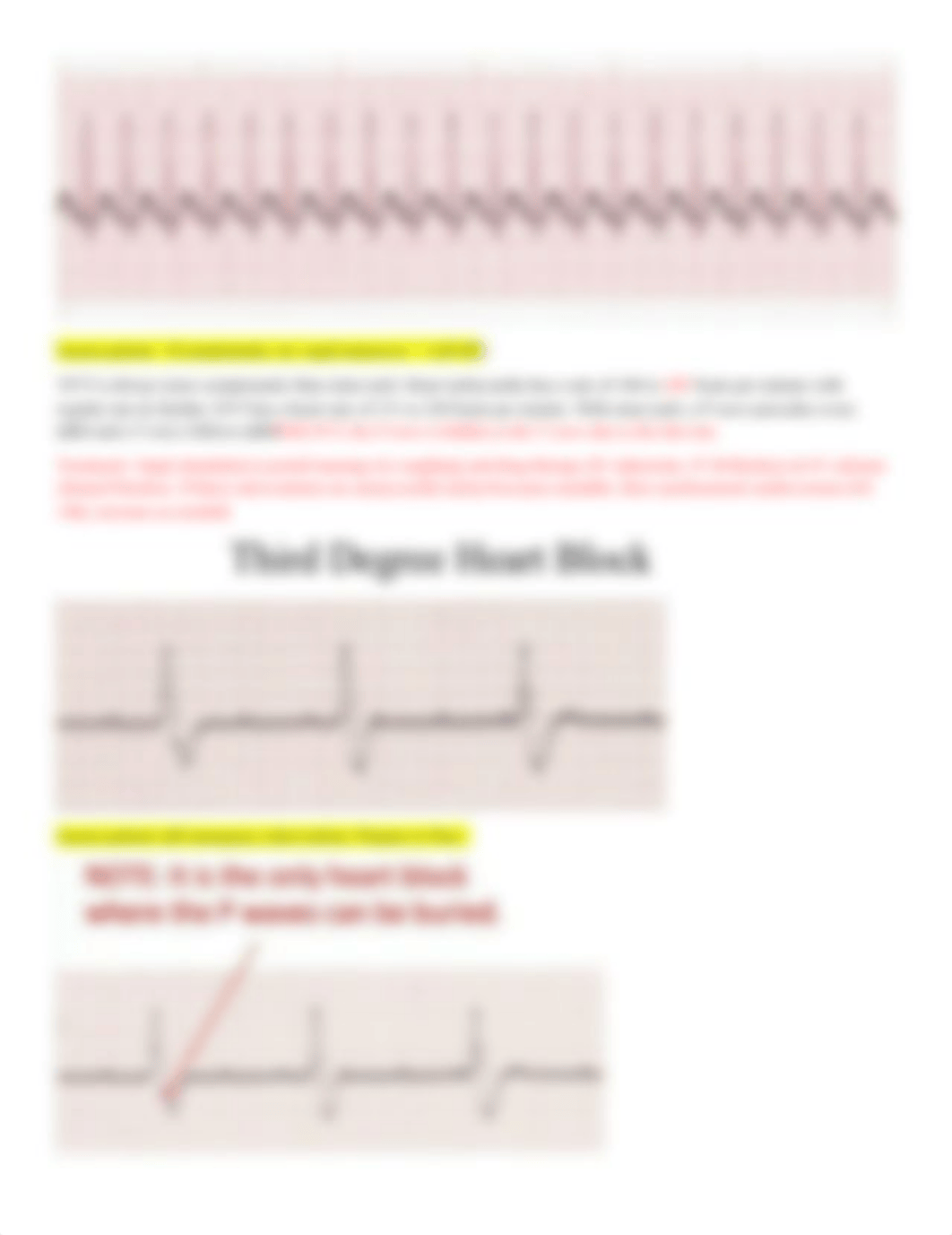 Extra ekg examples and study guide (1).docx_dxxmcyxhq9e_page4