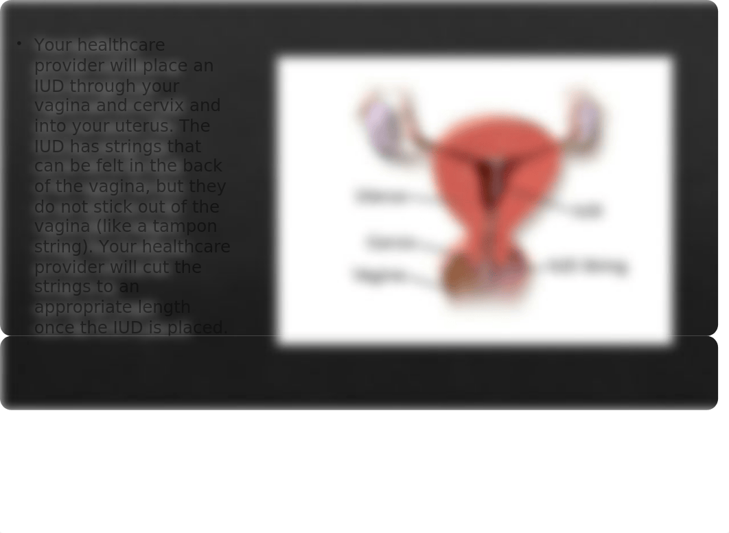 IUD powerpoint Maternity.pptx_dy4reb1i4jc_page5