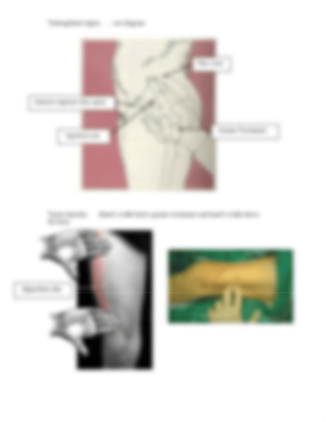 PHOTOS - Intramuscular Injection Sites.doc_dy57gd59tf1_page2