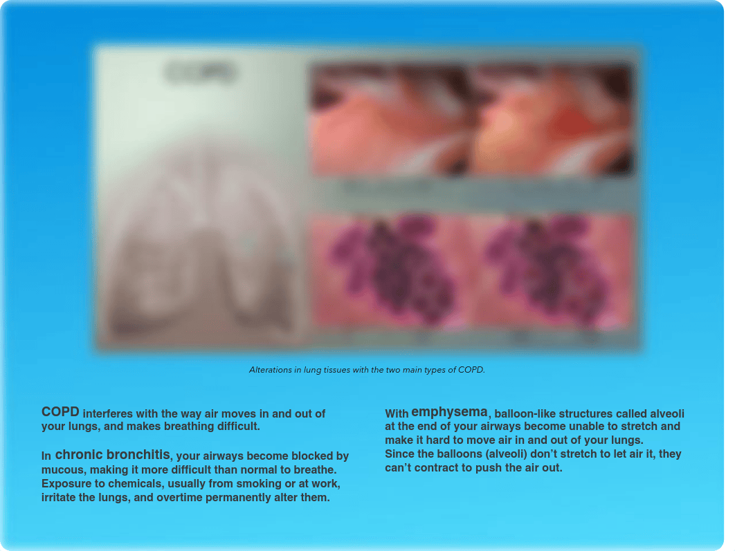 COPD Brochure.1.pdf_dy5izbnsrzr_page3