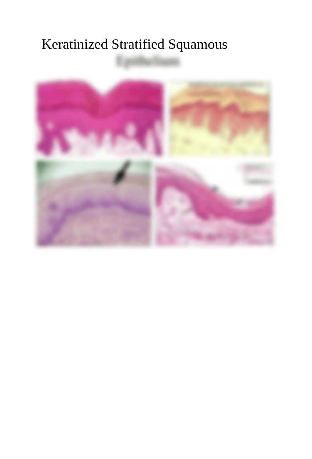 Keratinized Stratified Squamous Epithelium_dy6s4jfv233_page1