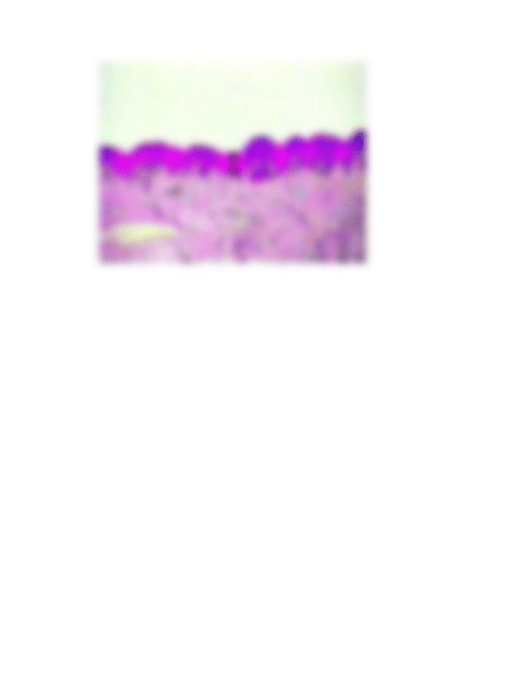 Keratinized Stratified Squamous Epithelium_dy6s4jfv233_page2