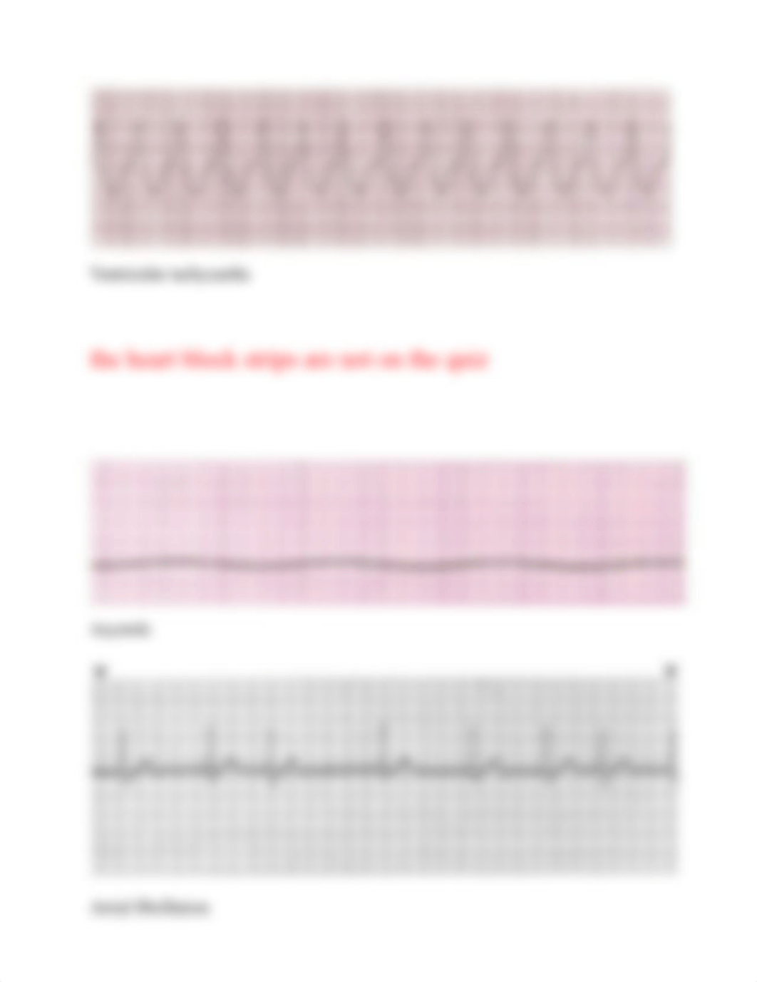 EKG Practice Strips Answers.docx_dy914s9j6a8_page3