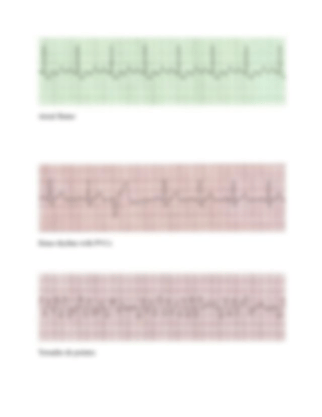 EKG Practice Strips Answers.docx_dy914s9j6a8_page2