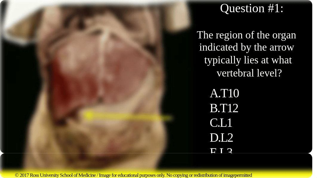 Supracolic and Infracolic Viscera (in-Class Assessment) spring 2018.pdf_dy9yy6yh5m0_page1