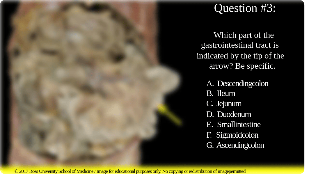 Supracolic and Infracolic Viscera (in-Class Assessment) spring 2018.pdf_dy9yy6yh5m0_page5