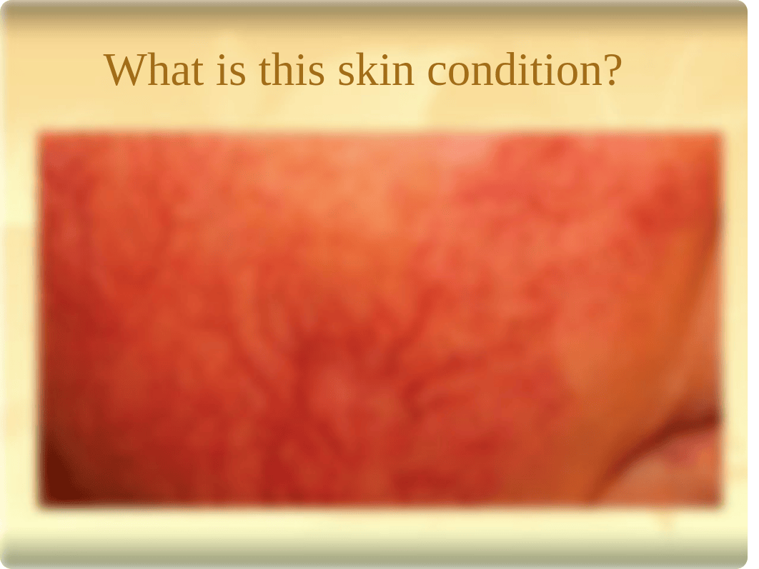 Skin Conditions .pptx_dyel4wypcdn_page3