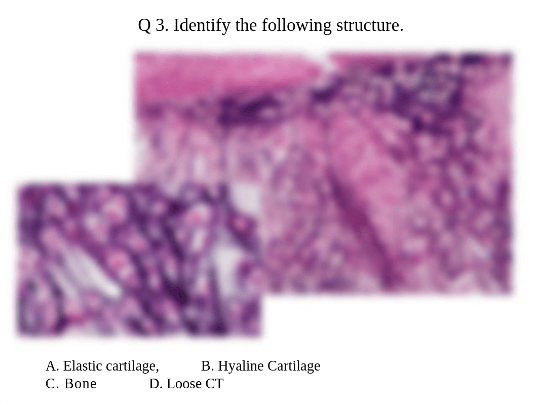 Final Exam Picture Quiz.ppt_dyerogas2c1_page4