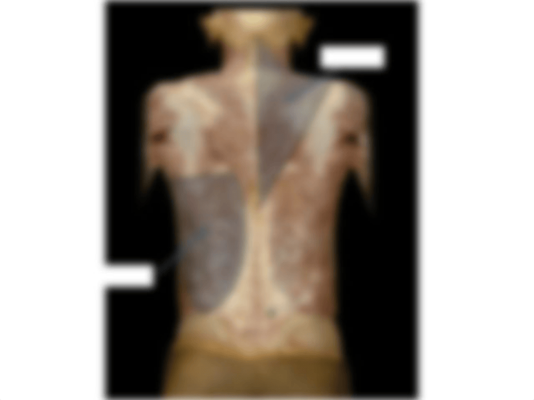 Exam 1 Blank IDs- vertebral column, back muscles_dygs74eqvzx_page2