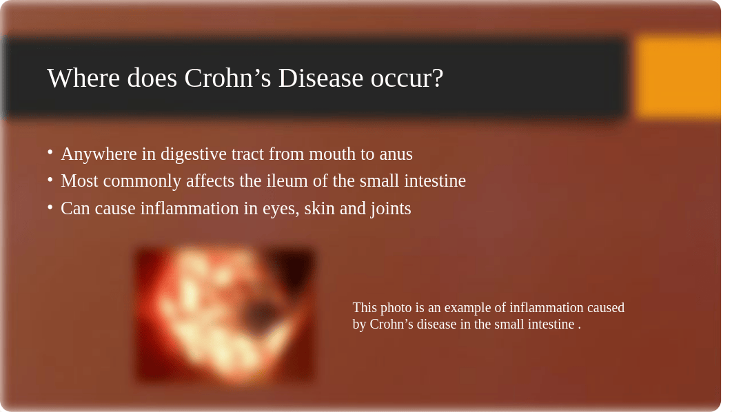 Crohn's Disease_dyicio7jo5y_page4