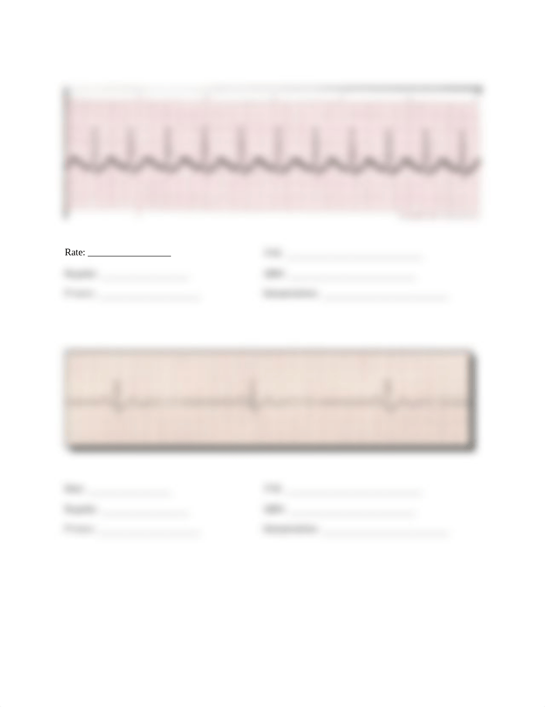 Student EKG tracing worksheet.docx_dykhe5921zz_page2