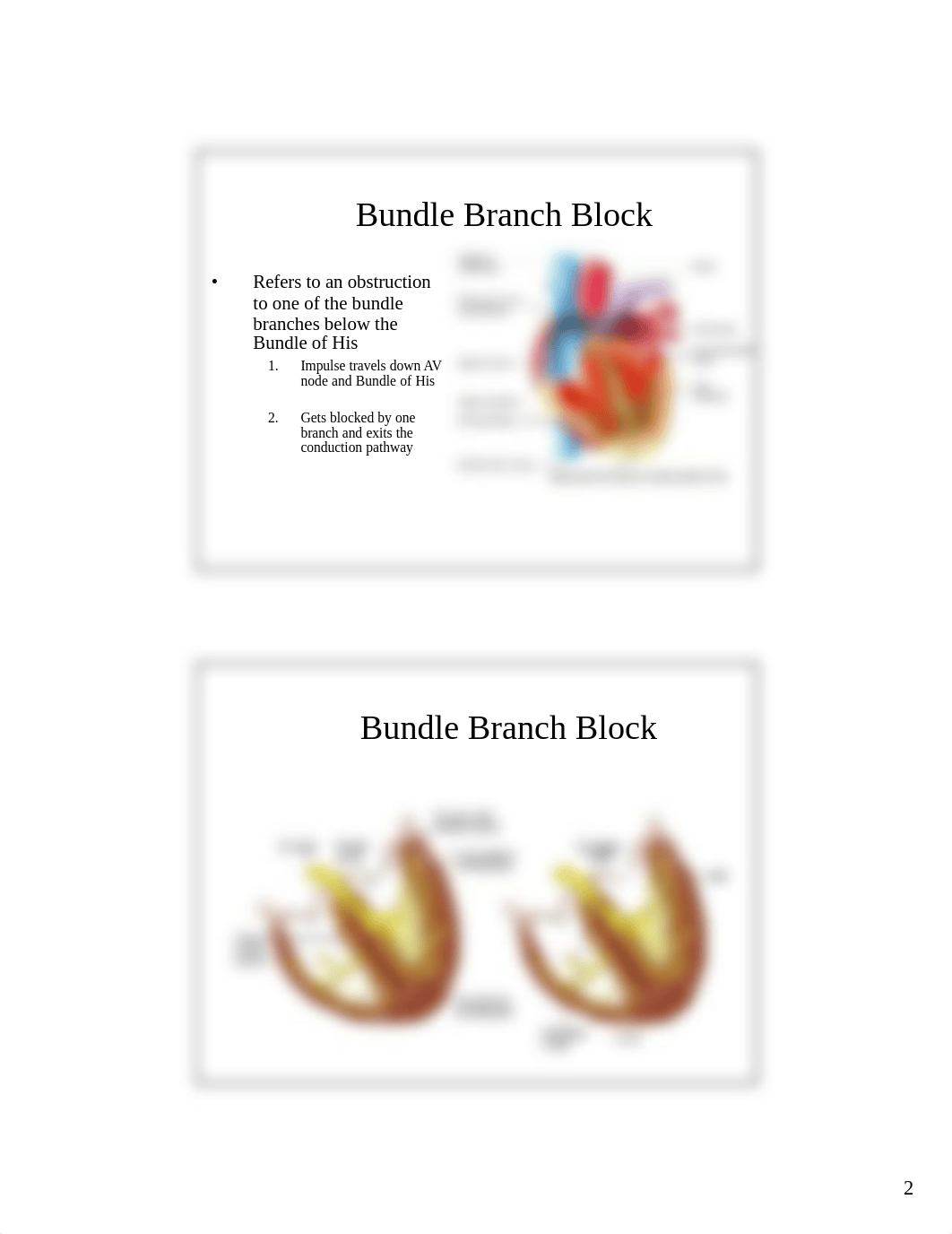 ekg interpretation 3.pdf_dyl6o45tw4w_page2