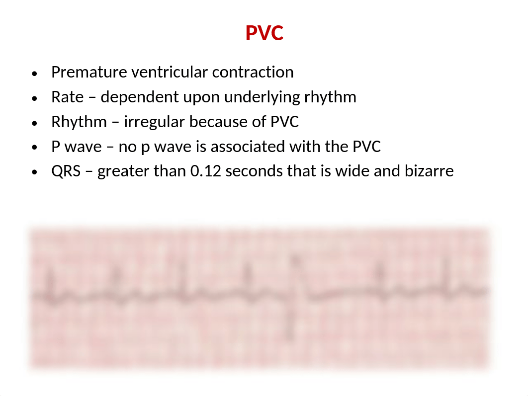 ECG part II.pptx_dylj5sip8nb_page4