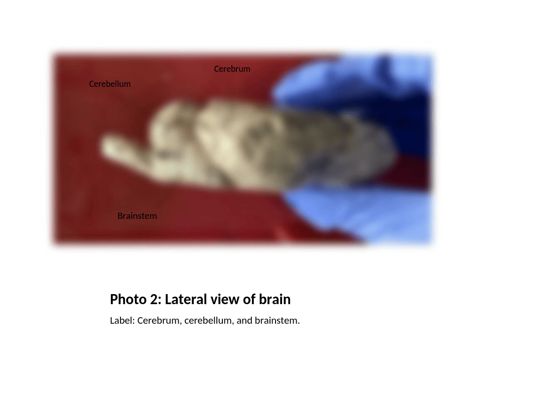 Sheep Brain dissection-Sydney Estes.pptx_dynqnt5es6g_page3