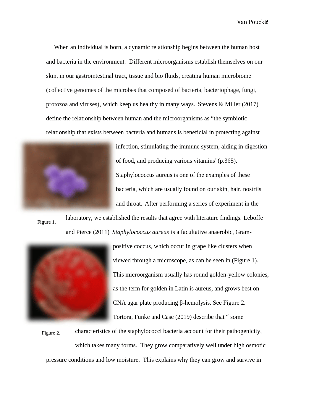 Stafilacoccus aureus.docx_dynu71pc8g6_page2