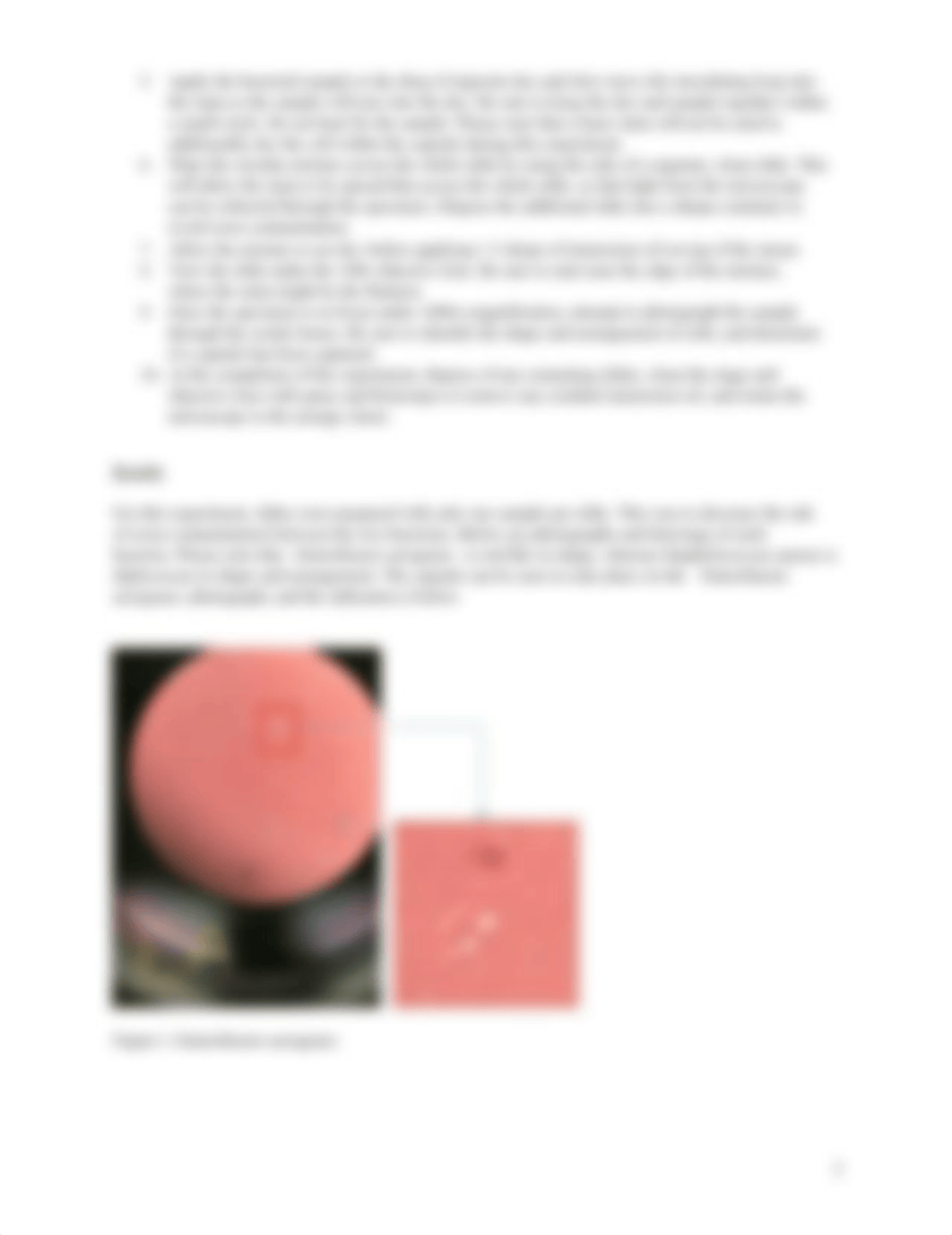 Lab Report 3B Negative-Capsule Staining.docx_dyrn7w3sxl2_page2