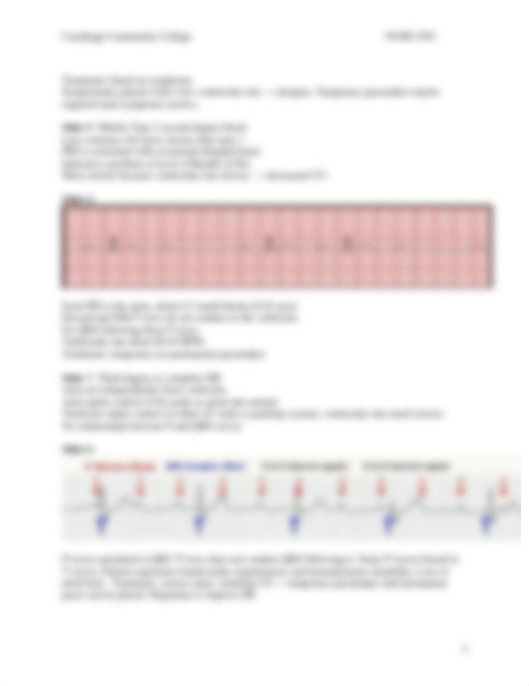 EKG Interpretation - Heart Blocks_Pacemakers_Student Handout RevFall16(1)(2).pdf_dysh5us0s85_page2