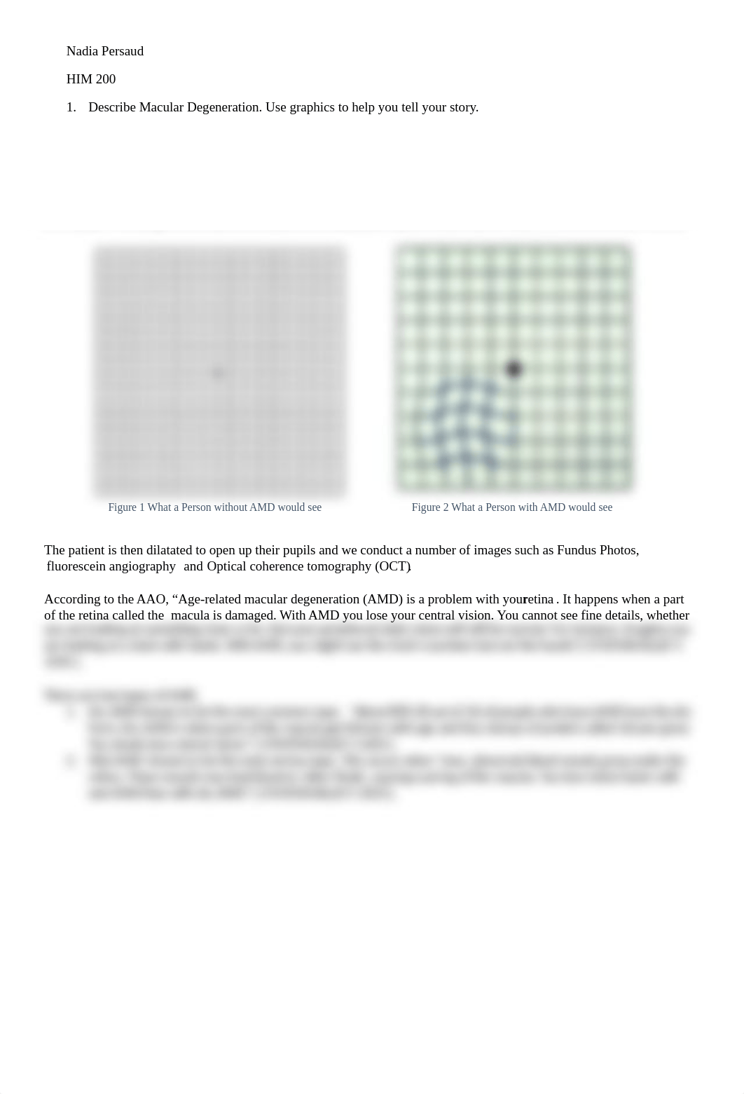 Macular Degen Assignment.docx_dz260gqbk07_page1