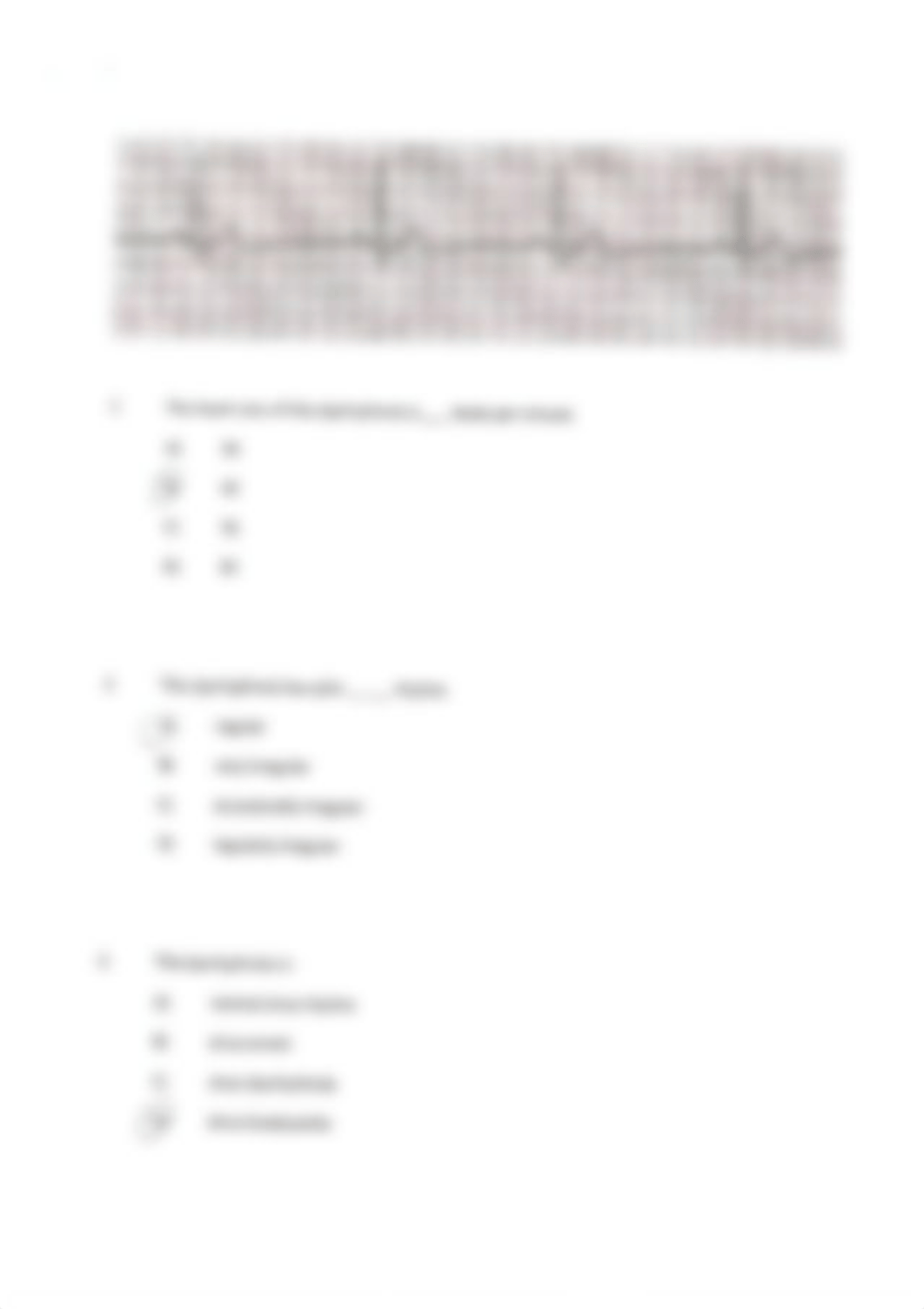 EKG Examples.pdf_dz2w5ac59i4_page3